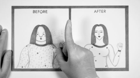 Before & After
