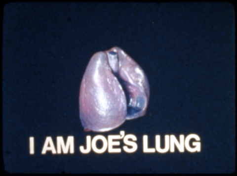 I Am Joe’s Lung
