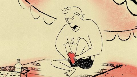 SunBurn