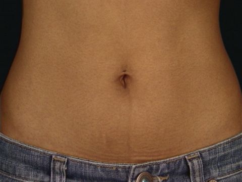 ONVZ: Bellybutton
